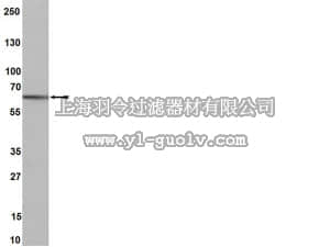 merck millipore,默克密理博,04-824,Anti-Estrogen Receptor β Antibody, clone 68-4, rabbit monoclonal