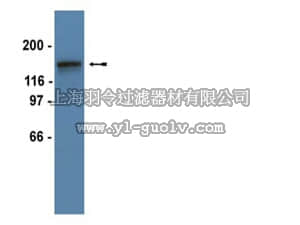 merck millipore,默克密理博,04-825,Anti-PDGFRβ Antibody, clone 4A56, rabbit monoclonal