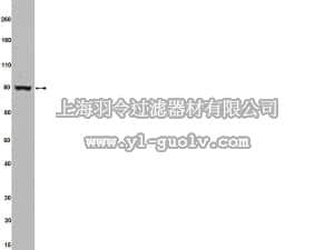 merck millipore,默克密理博,04-856,Anti-TBK1 Antibody, clone AOW9, rabbit monoclonal