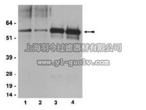 merck millipore,默克密理博,04-857,Anti-phospho-Src family (Tyr416) Antibody, clone 2N8, rabbit monoclonal