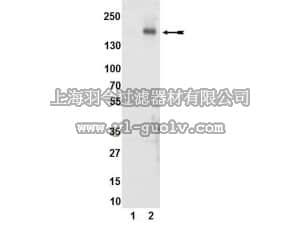 merck millipore,默克密理博,04-894,Anti-phospho-KDR/Flk-1/VEGFR2 (Tyr1054) Antibody, clone D1W, rabbit monoclonal