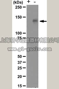 merck millipore,默克密理博,04-900,Anti-phospho-Met (Tyr1234/1235) Antibody, clone NL8,04-900