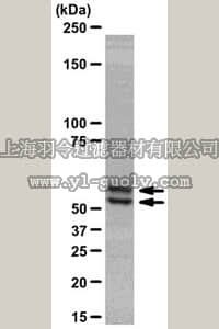 merck millipore,默克密理博,04-914,Anti-Smad2/3 Antibody, clone C4T, rabbit monoclonal