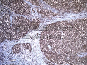 merck millipore,默克密理博,04-967,Anti-Desert hedgehog protein (DHH) Antibody, clone 19D7.2