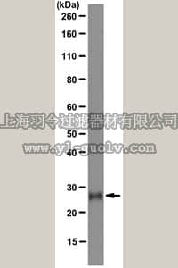 merck millipore,默克密理博,04-968,Anti-Folr4 (Folate receptor 4) Antibody, clone 5E12.2