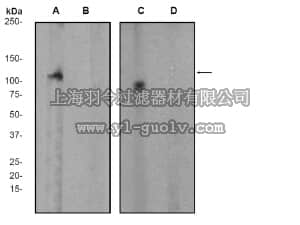 merck millipore,默克密理博,04-974,Anti-phospho-FAK (Tyr397) Antibody, clone EP2160Y, rabbit monoclonal