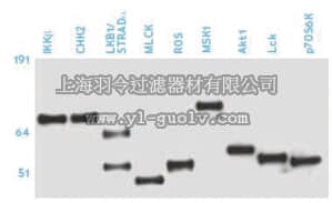 merck millipore,默克密理博,05-1000MG,Anti-Phosphoserine Antibody, clone 4A4