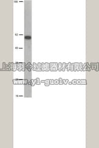 merck millipore,默克密理博,05-100,Anti-HDAC1 Antibody, clone 2E10