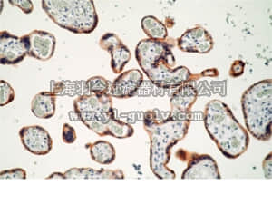merck millipore,默克密理博,05-1104,Anti-Insulin Receptor (β-Subunit) Antibody, clone CT-3