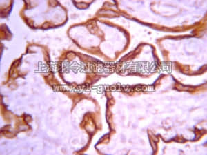 merck millipore,默克密理博,05-1106,Anti-IGF-IR Antibody, β-subunit, clone 1-2