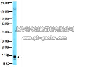 merck millipore,默克密理博,05-1117,Anti-VEGF Antibody, clone VG1