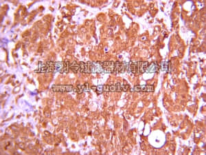 merck millipore,默克密理博,05-1130,Anti-erbB-2 Antibody, clone N3/D10 (Cytoplasmic Domain)