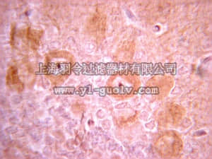 merck millipore,默克密理博,05-1135,Anti-PDGFR Antibody, clone CH-3
