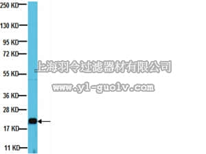 merck millipore,默克密理博,05-1149,Anti-ADP-Ribosylation Factor 6 Antibody, clone 6ARF01