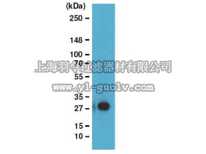 merck millipore,默克密理博,05-1312,Anti-Ubiquityl-Histone H2B Antibody, clone 56