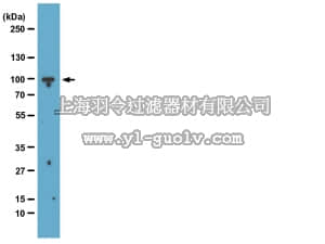 merck millipore,默克密理博,05-1319,Anti-EZH2 Antibody, clone BD43