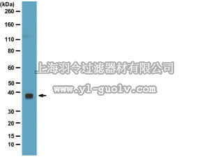 merck millipore,默克密理博,05-1322,Anti-Bmi-1 Antibody, clone DC9