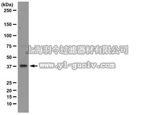 merck millipore,默克密理博,05-1361,Anti-PURA Antibody, clone 2B7