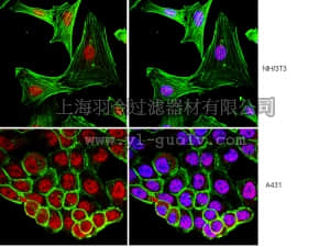 merck millipore,默克密理博,05-1362,Anti-RING1 Antibody, clone 4D6