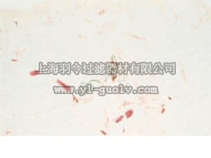 merck millipore,默克密理博,05-1424,Anti-Endoglin Antibody, clone P3D1