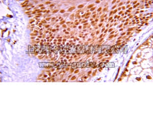 merck millipore,默克密理博,05-1427,Anti-ARF1 Antibody, clone 3F1