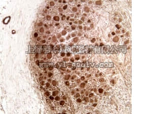 merck millipore,默克密理博,05-1430,Anti-Neurofibromin Antibody, clone NFn27b