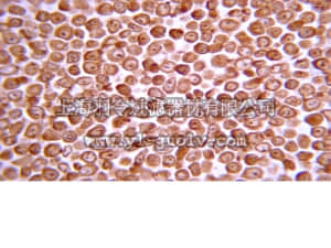 merck millipore,默克密理博,05-1431,Anti-Casein Kinase 2α Antibody, 1AD9