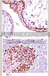 merck millipore,默克密理博,05-1571,Anti-IGF-1R Antibody, clone 24-57
