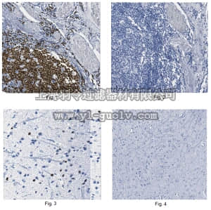 merck millipore,默克密理博,05-1573,Anti-Pax5 Antibody, clone 1H9