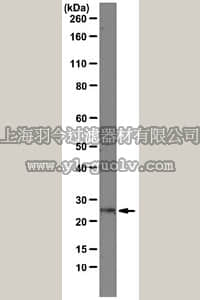 merck millipore,默克密理博,05-1574,Anti-Rab25 Antibody, clone 12C3