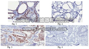 merck millipore,默克密理博,05-1587,Anti-FOXO3a/FKHRL1 Antibody, clone 15F7.2