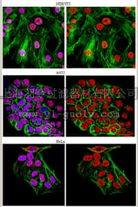 merck millipore,默克密理博,05-1588,Anti-U1-70K Antibody, clone 9C4.1