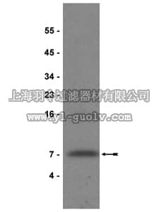 merck millipore,默克密理博,05-172,Anti-IGF-I Antibody, clone Sm1.2