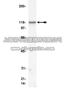 merck millipore,默克密理博,05-386,Anti-Vinculin Antibody, clone V284