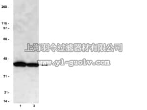 merck millipore,默克密理博,05-421,Anti-PP2A Antibody, C subunit, clone 1D6