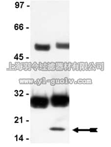 merck millipore,默克密理博,05-430,Anti-INK4b (p15) Antibody