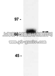 merck millipore,默克密理博,05-446,Anti-p75NTR (Neurotrophin Receptor) Antibody, clone ME20.4