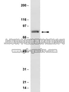 merck millipore,默克密理博,05-465,Anti-GRK 2/3 (βARK 1/2) Antibody, clone C5/1.1