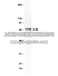 merck millipore,默克密理博,05-466,Anti-GRK 4-6 Antibody, clone A16/17