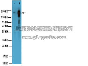 merck millipore,默克密理博,05-483,Anti-phospho-EGFR (Tyr1173) Antibody, clone 9H2