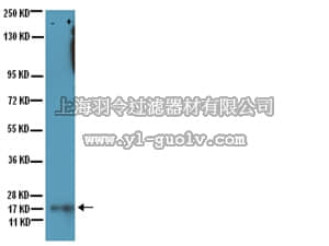 merck millipore,默克密理博,05-515,Anti-acetyl-Lysine Antibody, clone 4G12