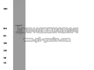 merck millipore,默克密理博,05-535,Anti-IKKβ Antibody, clone 10AG2