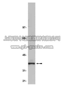 merck millipore,默克密理博,05-545,Anti-PP2A Antibody, C subunit, clone 7A6