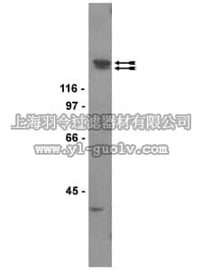 merck millipore,默克密理博,05-554,Anti-KDR/Flk-1/VEGFR2 Antibody, clone CH-11