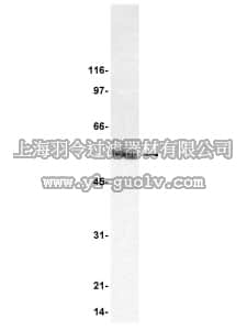 merck millipore,默克密理博,05-559,Anti-Tubulin βIII Antibody, clone 2G10, neuronal