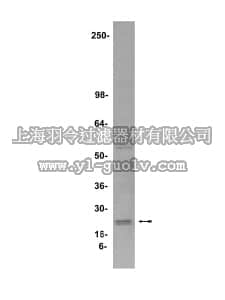 merck millipore,默克密理博,05-579,Anti-Endostatin Antibody, clone 1837.46