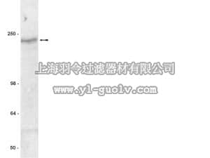 merck millipore,默克密理博,05-581,Anti-CFTR Antibody, clone MM13-4