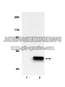 merck millipore,默克密理博,05-582,Anti-Herstatin Antibody, clone CW001
