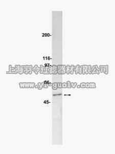 merck millipore,默克密理博,05-592,Anti-PP2A Antibody, B subunit, clone 2G9
