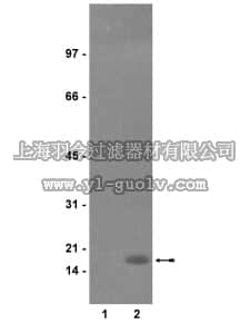 merck millipore,默克密理博,05-598,Anti-phospho-Histone H3 (Ser10) Antibody, clone RR002